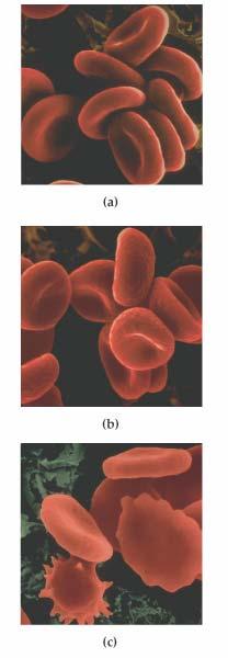 Red blood cells in (a) an isotonic solution are normal in appearance, while the cells in (b) (b) a hypotonic solution are swollen