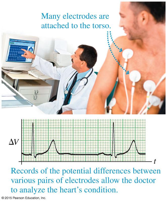 The Electrocardiogram A measurement of the electric potential of the heart is an invaluable diagnostic tool.