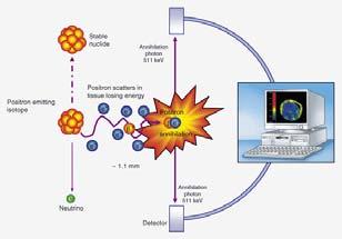 Positron Emission Tomography - PET Emission Detection Ring of detectors Gamma Photon #2 Isotope Max.