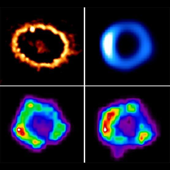 Supernova Remnants: SN1987A a c b d a) Optical Image (February 2000) Illuminating material ejected from the star thousands of years before the