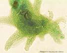 Amoeba (Sarcomastigota: Amebozoa) Food Vacuoles Nucleus