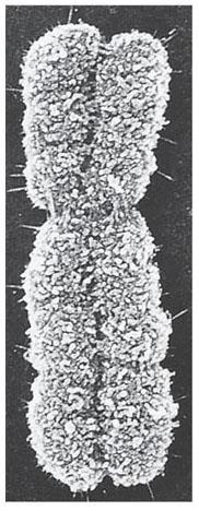 TEM 36,000 Before a cell starts dividing, the chromosomes replicate Producing sister