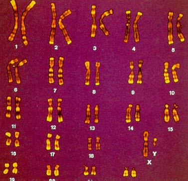 Karyotypes A karyotype is a pictoral spread of an individual s