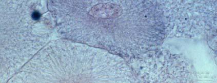Mitosis division of the nucleus 1. prophase 2. metaphase 3.