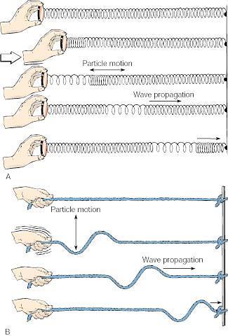 (A)A P-wave is illustrated by a sudden push on a stretched spring.