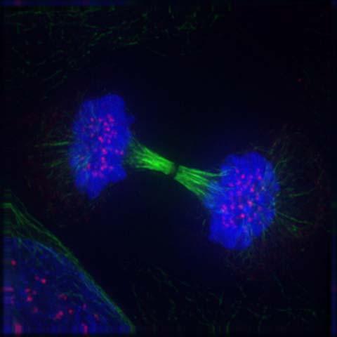 jpg Cytokinesis The cytoplasm divides Animal cells Cleavage furrow