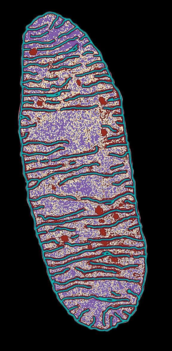 2 µm (organelle):