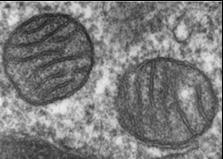 Time: 2 Hours Page 4 of 20 5. Which instrument was used to produce the following image of mitochondria? A. compound light microscope B. scanning electron microscope C. simple light microscope D.