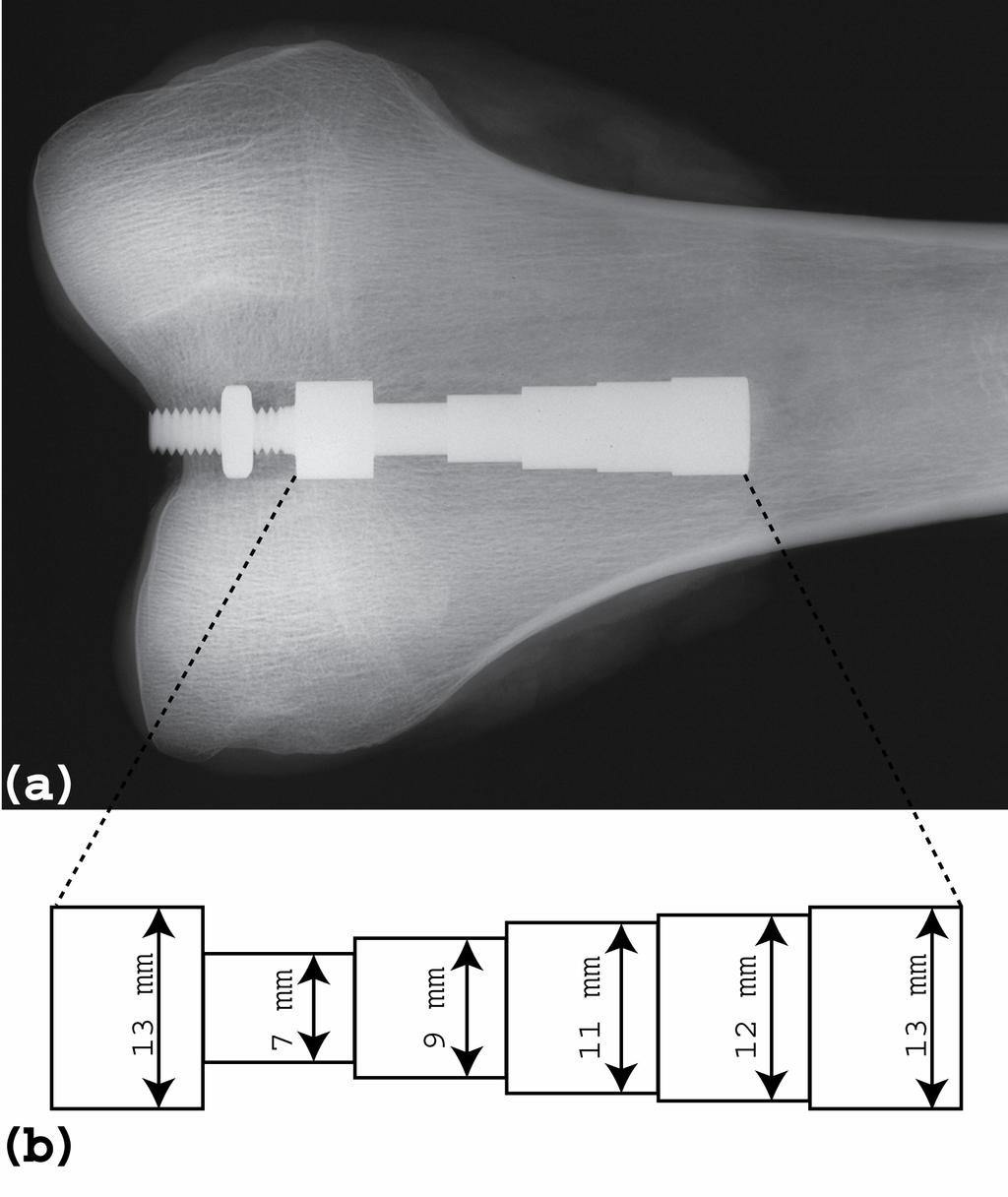 Figure 4.2 (a) A contact x-ray (Faxitron) of the distal femur with the stepped titanium implant inserted.
