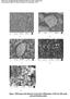 Figure : SEM image of all adsorbent (A)Coal dust, (B)Bentonite, (C)Fly ash, (D)Laterite soil and (E)Sodium zeolite